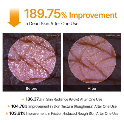 Turmeric+ Kojic Body Peel Shot