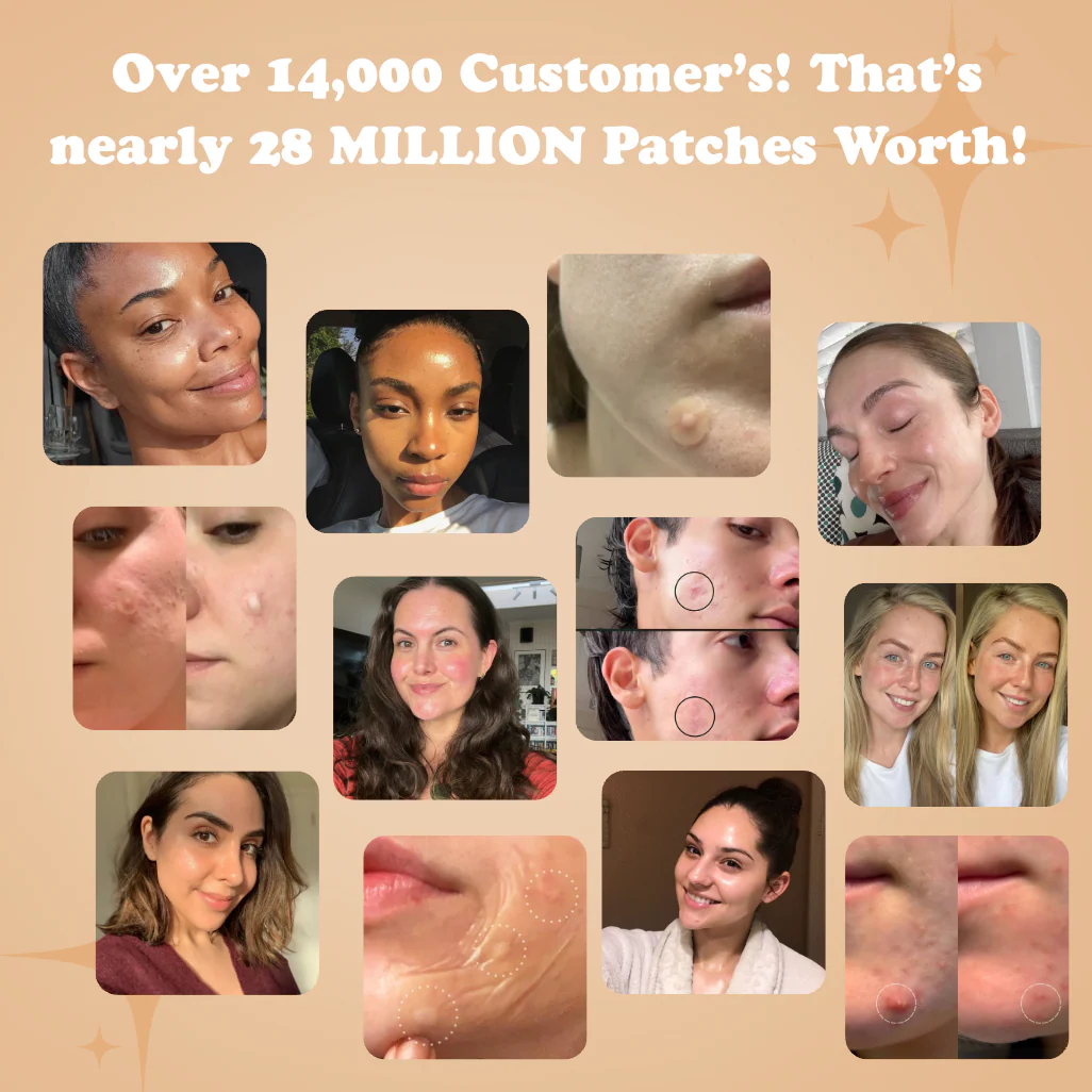 Blemishes B'Gone Roll